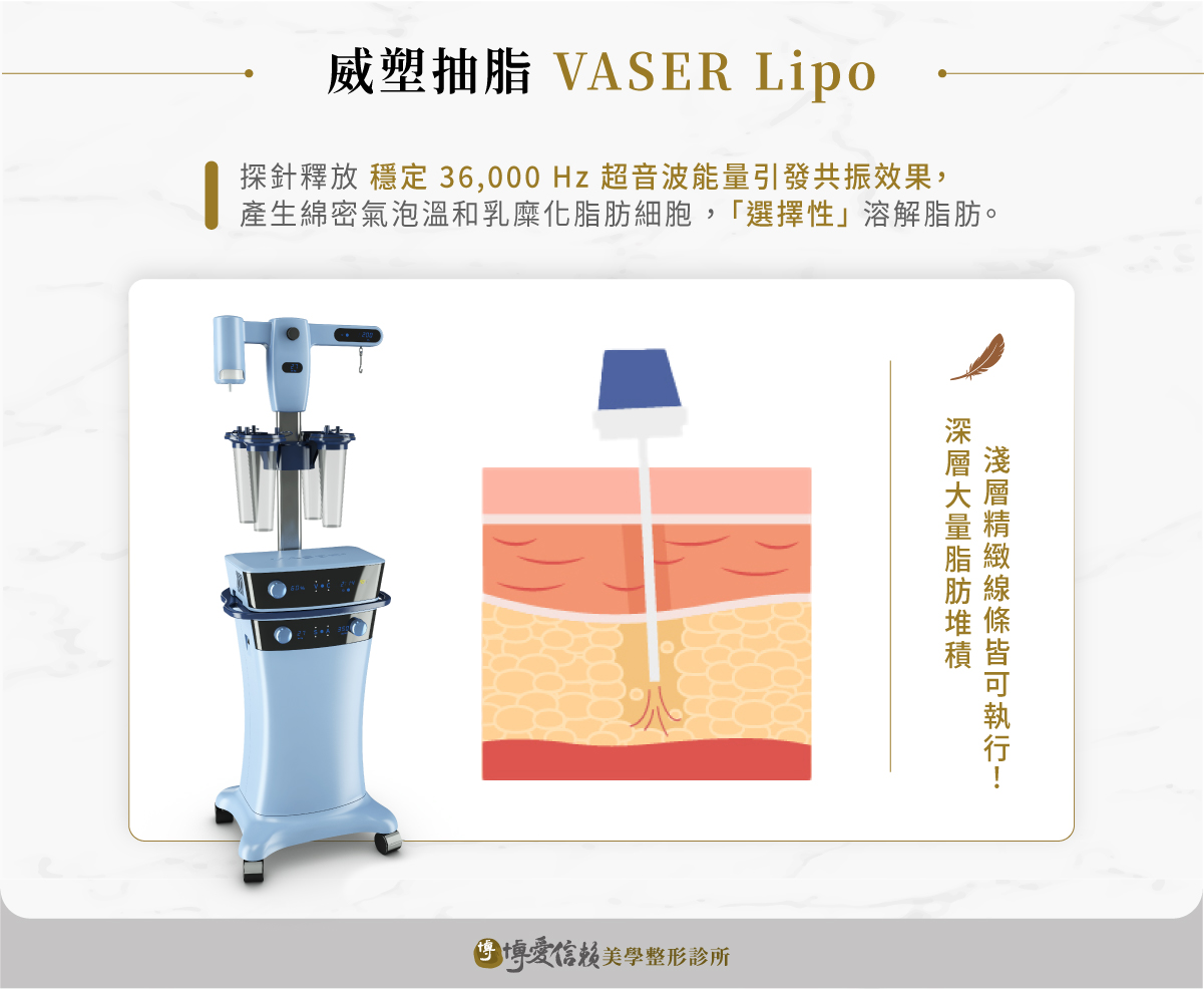 威塑抽脂利用超音波能量輔助抽脂,以「先溶解脂肪再引流」的方式讓脂肪團塊變得較容易被帶走