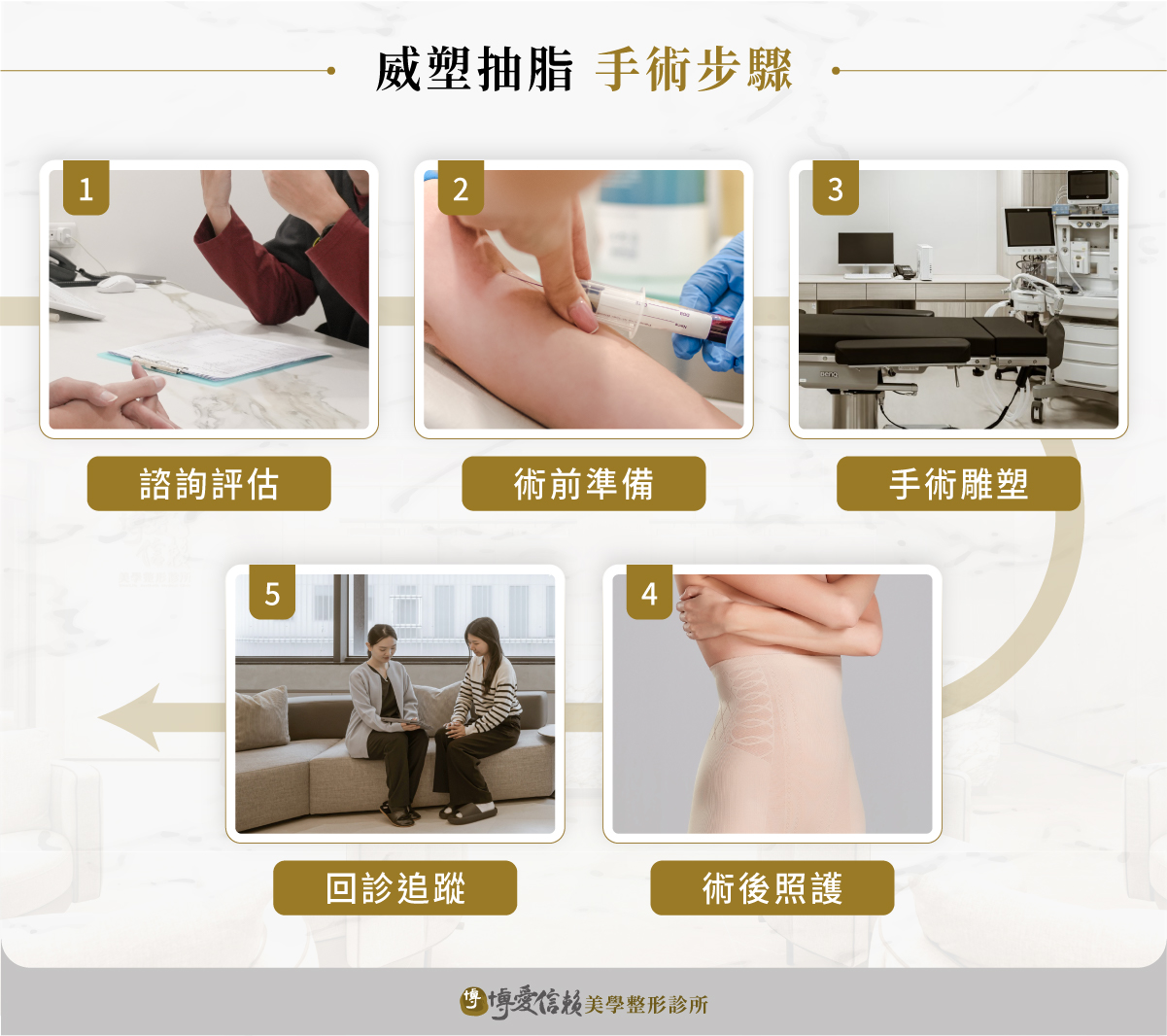 威塑抽脂手術 5 步驟流程:諮詢評估、術前準備、手術雕塑、術後照護、回診追蹤