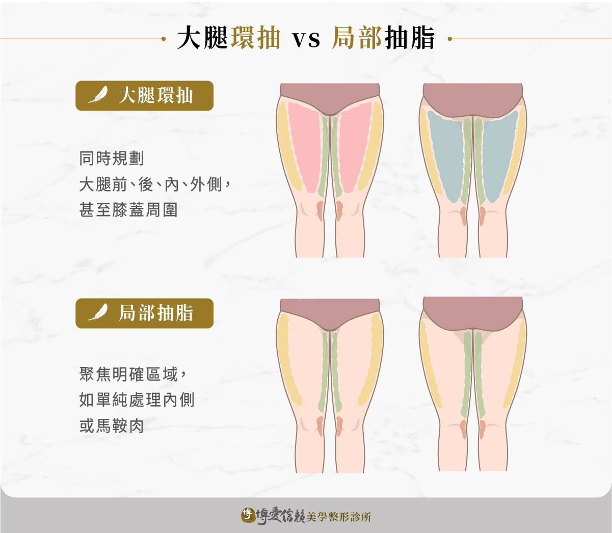 大腿環抽 vs 局部抽脂