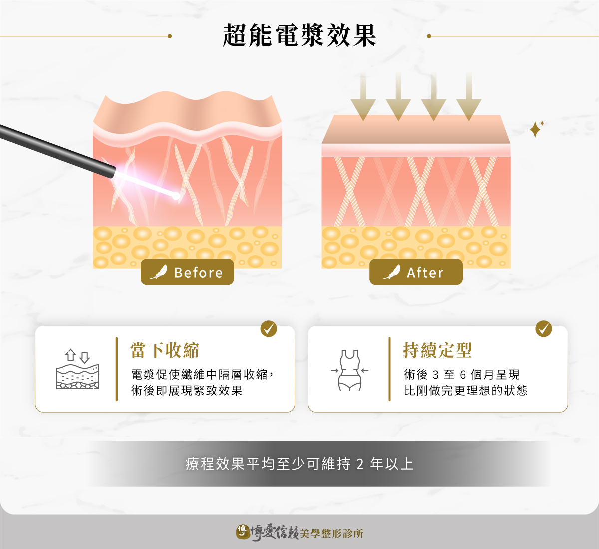 超能電漿效果會在術後立即收縮並持續定型緊實肌膚