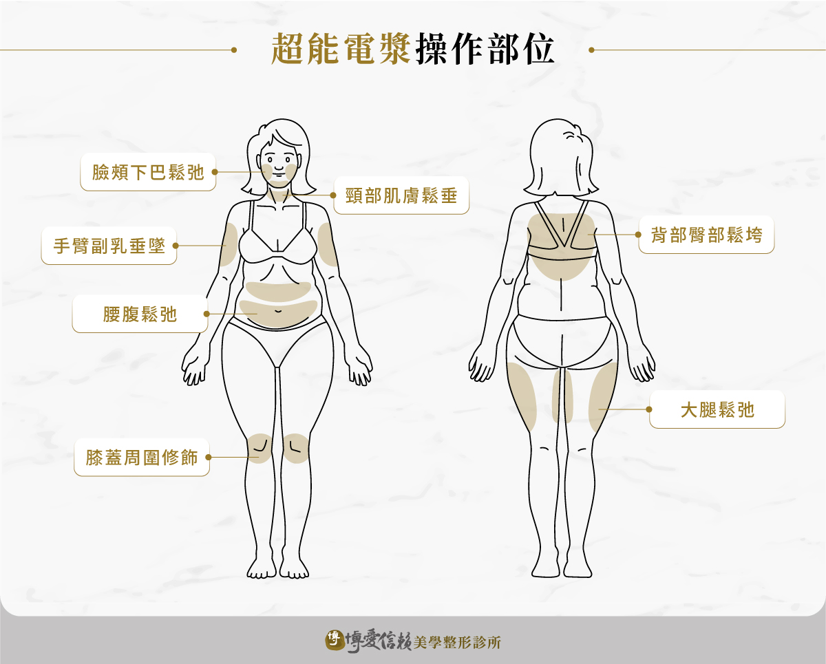 超能電漿部位：臉頰、下巴、手臂、腰腹、膝蓋、頸部、背部、大腿等鬆弛部位
