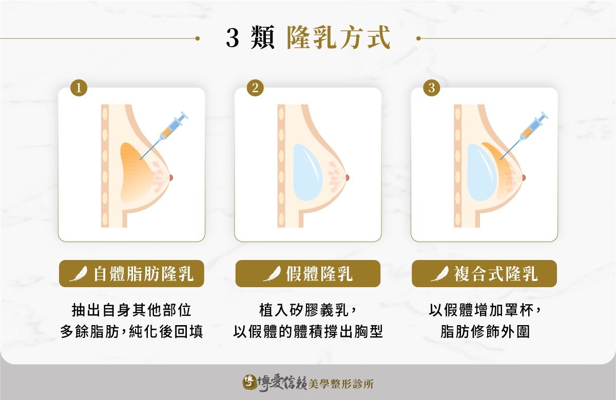 3 類隆乳方式:自體脂肪隆乳、假體隆乳、複合式隆乳