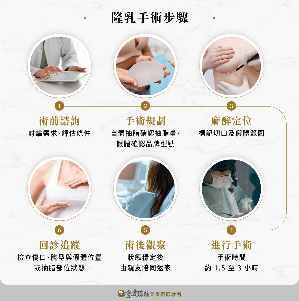 隆乳手術 6 步驟:術前諮詢、手術規劃、麻醉定位、進行手術、術後觀察、回診追蹤