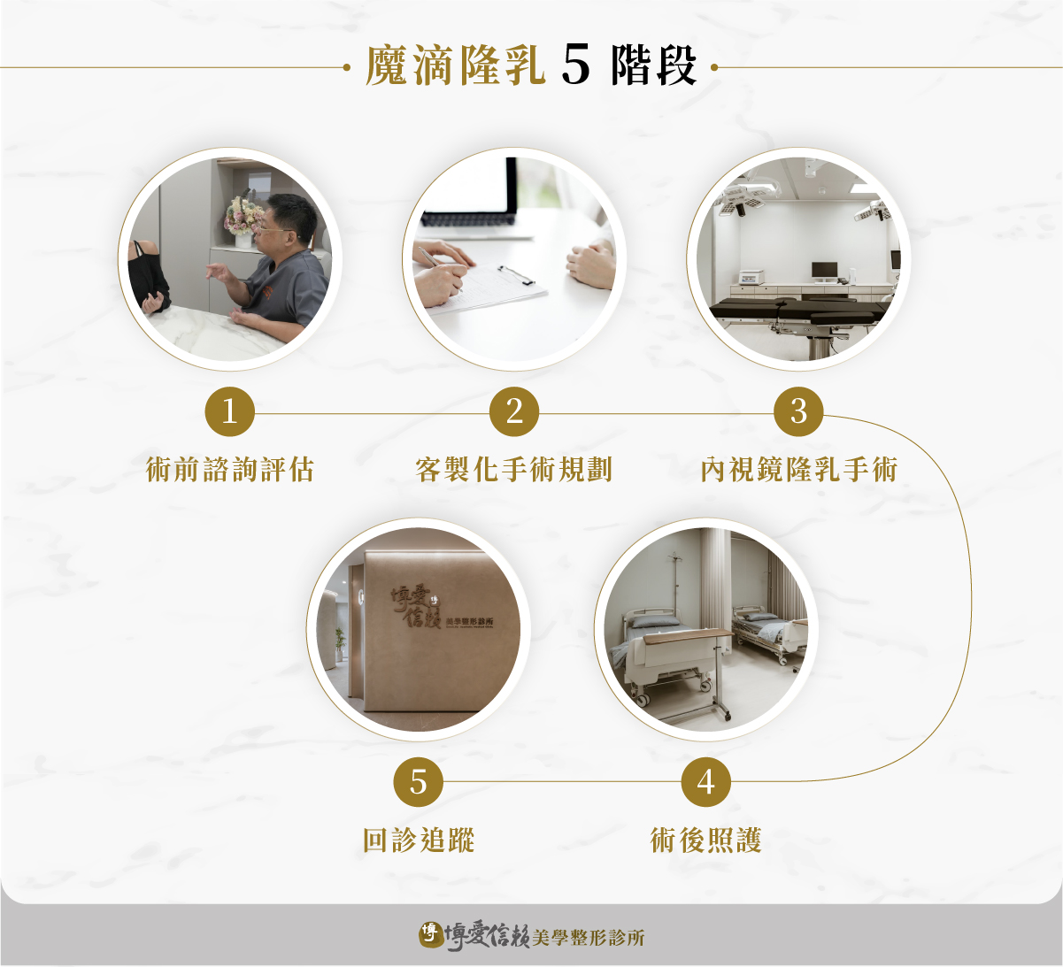 待替換圖片|檔名:Motiva Breast Augmentation: 5 Stages — Pre-operative consultation, surgical planning, endoscopic breast augmentation, post-operative care, and follow-up visits..jpg 魔滴隆乳手術5階段:術前諮詢、手術規劃、內視鏡隆乳手術、術後照顧、回診追蹤