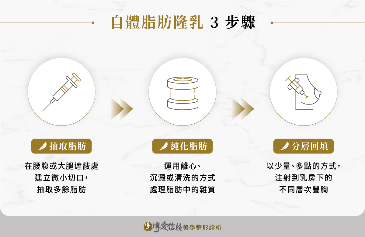 自體脂肪隆乳3步驟:抽取脂肪、純化處理、回填豐胸