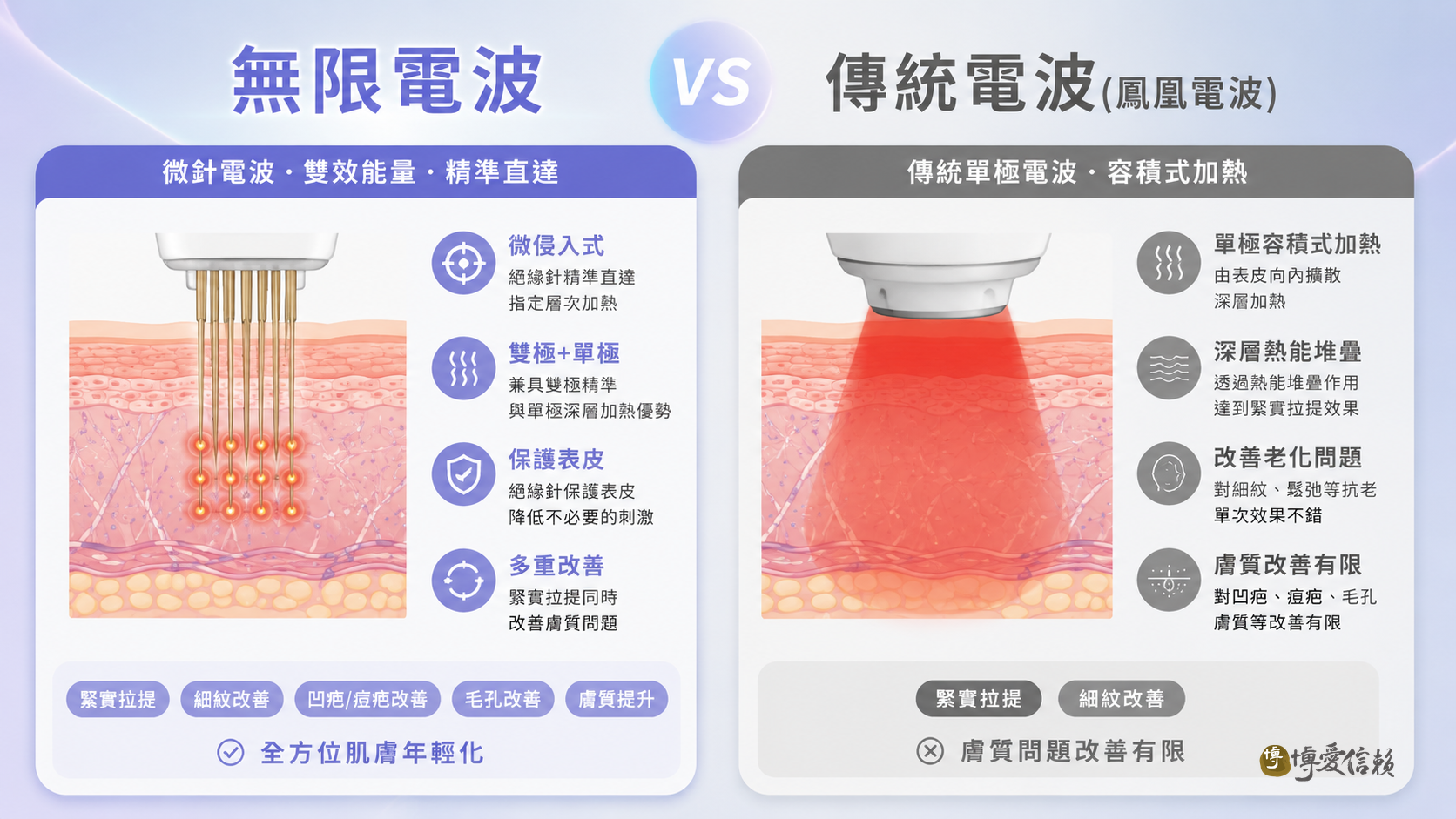 無限電波與傳統電波比較